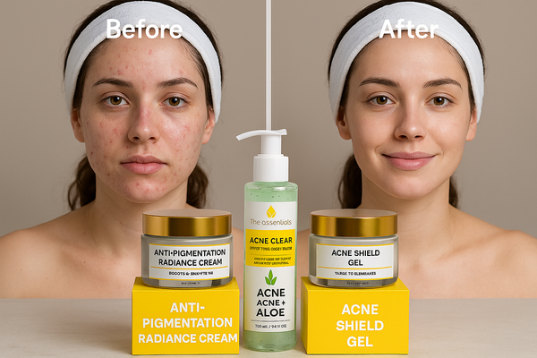 Acne Free Bundle