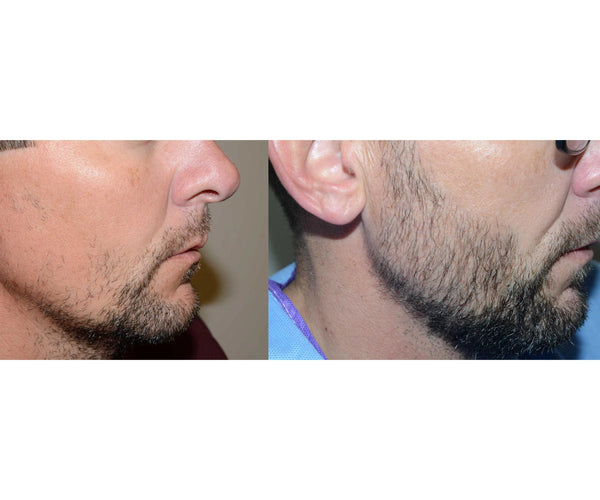 Beard Oil